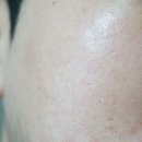 다이소 화장품 메디필 엑스트라 슈퍼9 앰플 쫀쫀해진 후기