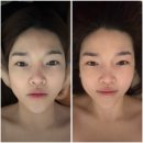 한국레이져메디칼 | 상왕십리 에스테틱 리연에서 찾은 속광! 25년 경력의 쎌 광채 톤업 테라피 후기