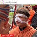 [F1] 랜도 노리스, 네덜란드 국왕 파티에서 코뼈 골절 이미지