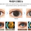 비타민안경.콘택트 이미지