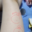 2026. 5~2026.7.14 현재진행형/팔과다리에 43군데 전파와 음파로 난도질 이미지