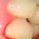 부마치과 이미지