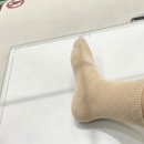 주  정형외과 | 발 전문 정형외과 방문 후기 치료 과정 및 비용 정리