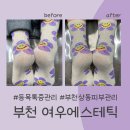 여우 | 부천상동피부관리 여우에스테틱 후기 🦊
