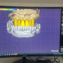 이처럼치과기공소 이미지