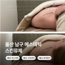 남구-104 | 울산 남구 에스테틱 스킨뮤제 예신 신부 윤곽 피부 관리