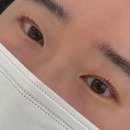 분당 속눈썹펌 '니드유브로우' 속쌍커풀 시술 후기