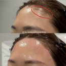 부평시장역4번출구약국 | [리뷰] 인천 부평시장왁싱 유니르왁싱 부평점 - 헤어라인 눈썹 왁싱 솔직후기