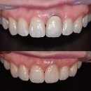 덴치과기공소 이미지