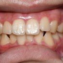 비우고채우는치과의원 이미지