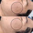 완산-147 | 전주 피부관리 오로라필 효과｜모공·피지·피부결 한 번에 정리한 관리 후기