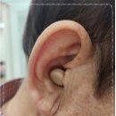 우리독일보청기 네이버블로그