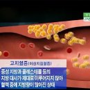 콜레스테롤에 대한 감추어진 진실 이미지