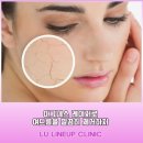 아그네스 이미지