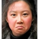 홍조 네이버블로그