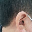 시그니아독일보청기대구북구센터 이미지