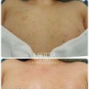 천안 RPC 이미지