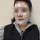 선보피스점 | 20대 후반 리프팅 관리 - 인모드 대신 ‘온다리프팅’ 받은 솔직후기 (통증/붓기/느낌 정리)