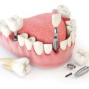 에이스치과의원 이미지