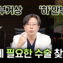 리프트업성형외과의원 | 브이리프트 vs 걸리버리프트 차이점!동안 vs 처짐개선 리프팅 수술 비교 정리 [다움성형외과 김대현 원장]