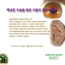 백내장 수술을 받은 사람의 황반 변성증 / 생활이침.홍채임상학 -최만규 교수- 이미지