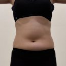 백양메디칼센터 | 부산다이어트 지방분해주사 첫번째 레슨 좋은건 나만알기