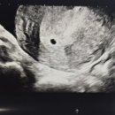 슬기로운산부인과의원 이미지