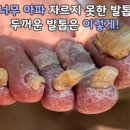 레푸스 화정점 이미지