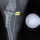 주식회사 오버레이 | 좌측 TPLO를 통한 전십자인대 단열 교정 및 재활 치료로 보행 회복에 성공한 증례