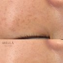 러버블리 이미지