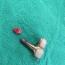 채움치과기공소 | 김포 임플란트 치과 추천? 지식IN, 카페 글에 속지 마세요