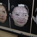 청담가구갤러리 | ​메타뷰 진단 압구정로데오역 청담피부과, 온다리프팅 6만줄 솔직후기