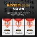 강서고려비뇨의학과의원 | 전립선비대증 유로리프트 비용과 효과 후기를 비교해보면