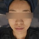 달리아 - 강남구 압구정로28길 48 | 서면 트러블 블랙헤드관리 서면 압출관리 후기 달리아에스테틱