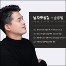 포인트성형외과의원 네이버블로그