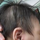뺑뺑이 | [쌍둥이육아일기] 인하대병원 입원후기1 - 영유아 응급실뺑뺑이