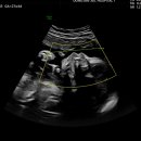 동탄제일병원 이미지