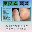 달성내과의원 네이버블로그