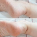 ㈜그린정비 | 멀티밤 한혜진 PICK 올라운드 보습템 넛세린 밤 시즌4