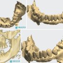 케이치과의원 | 청라 네비게이션 임플란트 치과 후기 진료