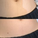 [부천 송내] 송내왁싱 ‘뷰티덕분’ 솔직후기｜슈가링왁싱으로 등+이마+헤어라인+배렛나루 싹 다 뜯어...