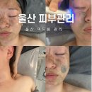 앤드뷰티 - 여수시 신기남1길 29-1 | 울산 북구 여드름관리 문제성피부 LDM 재생관리 뷰티앤드 후기