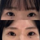 2721 | 수원 속눈썹펌 수원역 속눈썹펌 '늘온뷰티' 클리닉 3단계 후기
