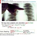 #CNNNews #KhansReading 2016-12-12-2 The lung cancer symptoms even nonsmokers need to know 이미지