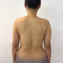 이글메디칼 | (내돈내산 재재방문) 물리치료사가 추천하는 진주등관리 진주에스테틱 맛집 더안뷰티