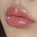 신의의원 | 청주 아티움의원 입술필러 리터치 후기