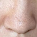 스위트의원 이미지