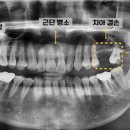 수원탑플란트치과의원 이미지
