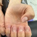 나성동네일 손발네일 및 문제성 내성 발톱 관리를 같이 진행하는 네일샵 아이패디