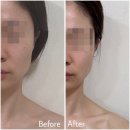 아름드리 | 방배동피부관리 이수역 아름드리에스테틱 솔직후기